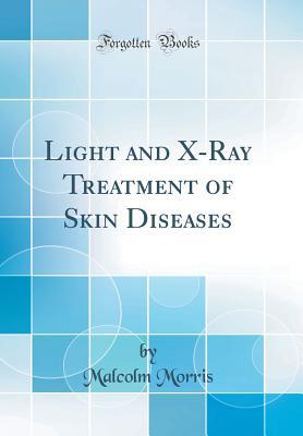 [e3f76] *Read^ %Online% Light and X-Ray Treatment of Skin Diseases (Classic Reprint) - Malcolm Morris %P.D.F%