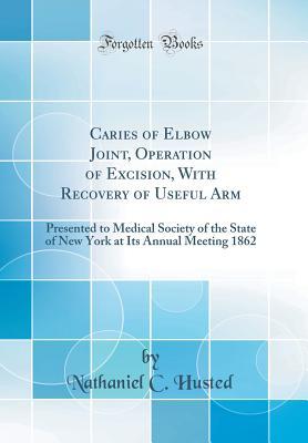 [9742d] @Read@ Caries of Elbow Joint, Operation of Excision, with Recovery of Useful Arm: Presented to Medical Society of the State of New York at Its Annual Meeting 1862 (Classic Reprint) - Nathaniel C Husted %e.P.u.b@