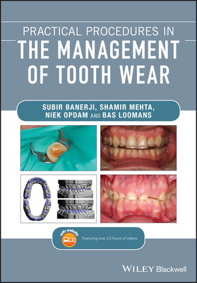 81163] @D.o.w.n.l.o.a.d@ Practical Procedures in the Management of Tooth Wear - Subir Banerji !P.D.F!